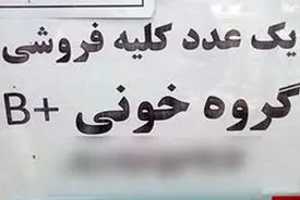 معاوضه عضو بدن با ماشین / بازار زیرزمینی اعضای بدن دوباره خبرساز شد