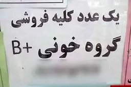 معاوضه عضو بدن با ماشین / بازار زیرزمینی اعضای بدن دوباره خبرساز شد